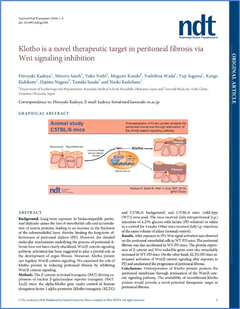 Nephrology Dialysis Transplantation誌に角谷先生の論文が掲載されました