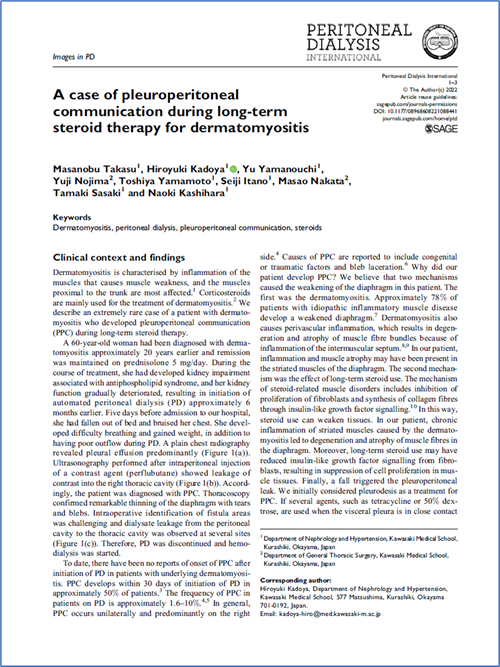 髙須将伸先生の論文がPeritoneal Dialysis International誌に掲載されました